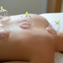 Cupping Therapy3