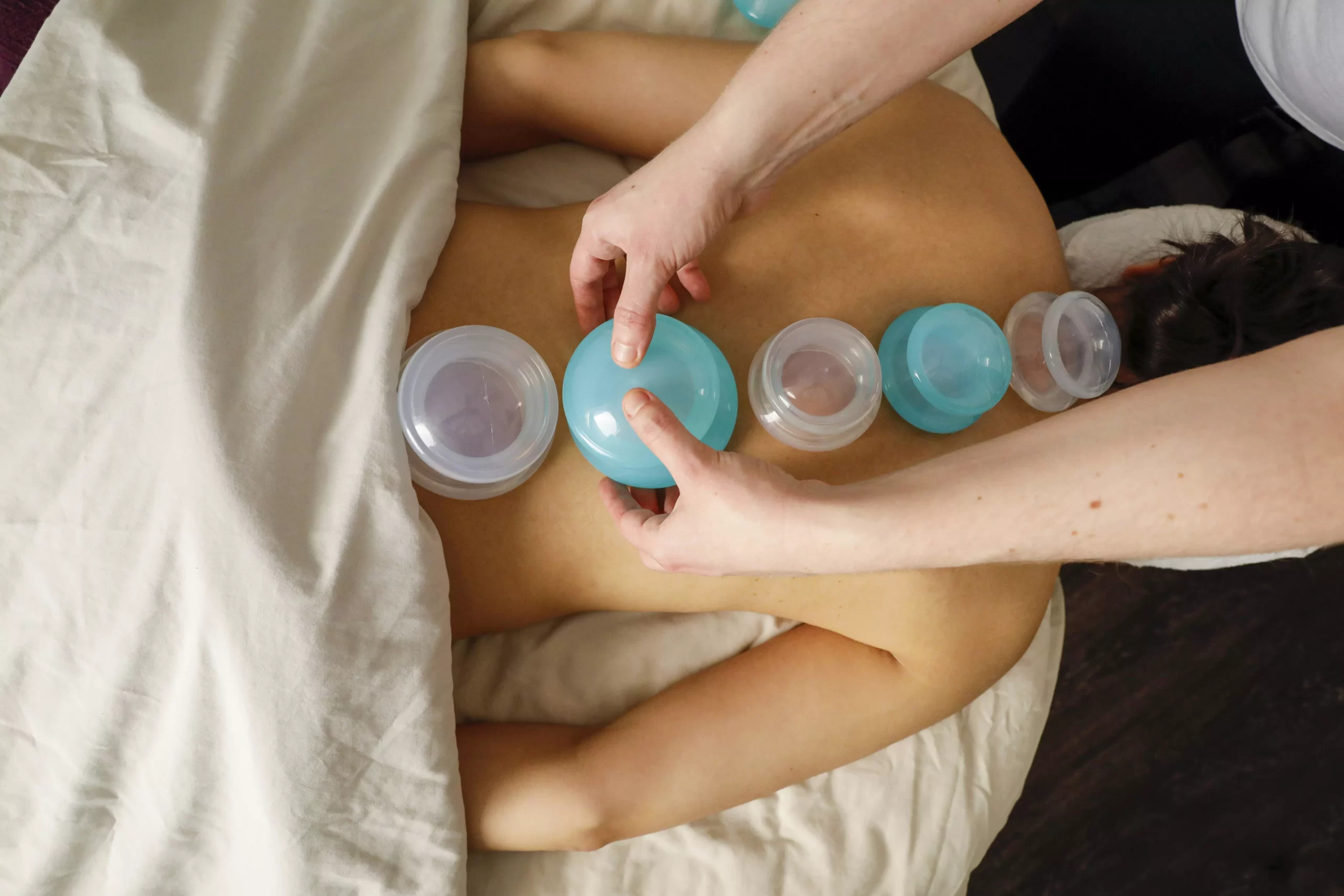 Cupping Therapy5